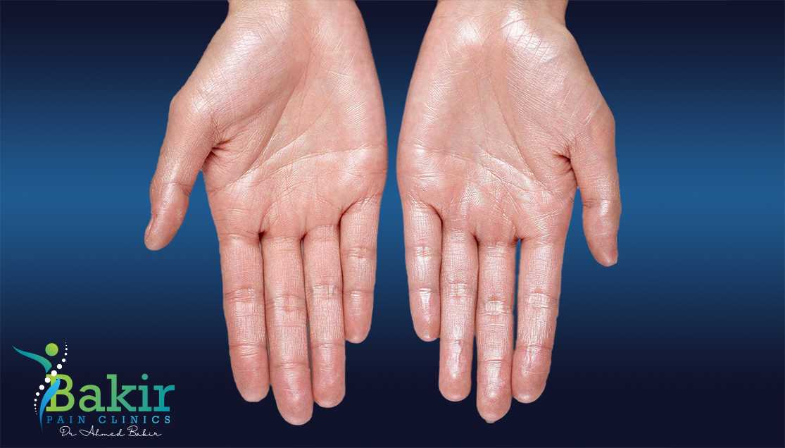 البوتكس - علاج زيادة التعرق في اليدين و القدمين  -حقن البوتكس لعلاج التعرق