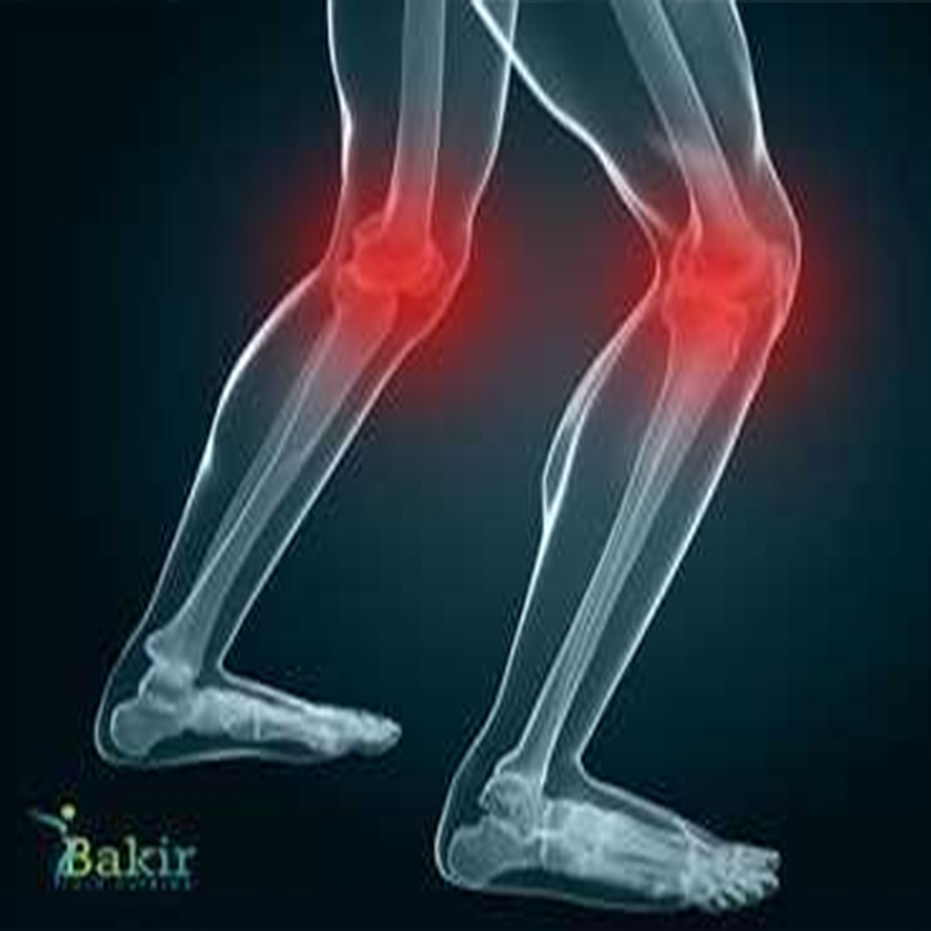 خشونة المفاصل - الألم المفاصل - خشونة الركبة - علاج خشونة الركبة