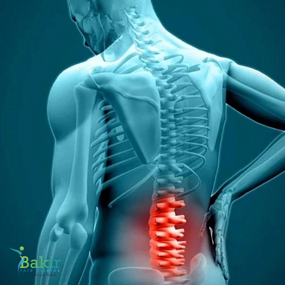 علاج الانزلاق الغضروفي في الظهر